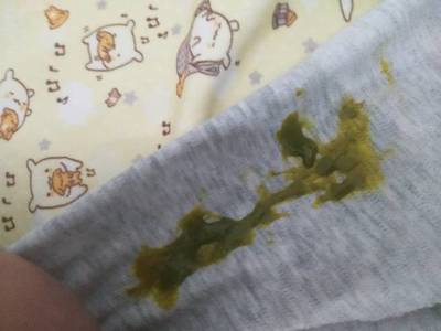 宝宝拉粑粑绿色