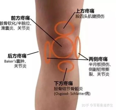 膝关节滑囊炎怎么治疗
