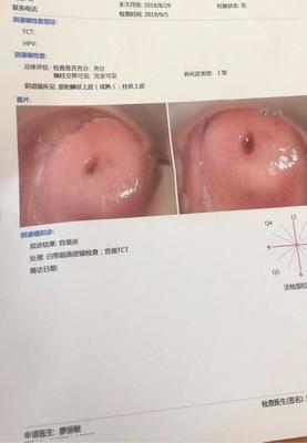 宫颈囊肿是怎么回事
