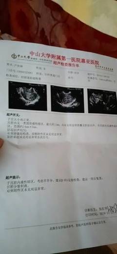 胎儿一般多久有胎心