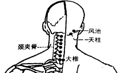 颈与项的区别