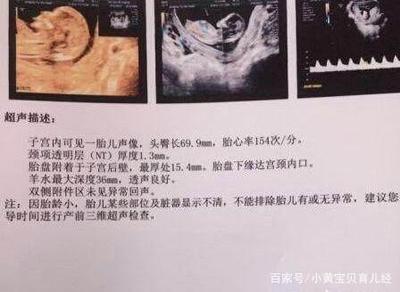 孕妇唐筛需要空腹吗