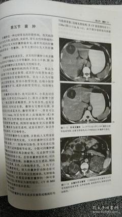 全身mri检查要多少钱