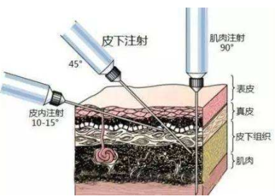 水光针后注意事项