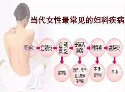 长期附件炎会怎么样