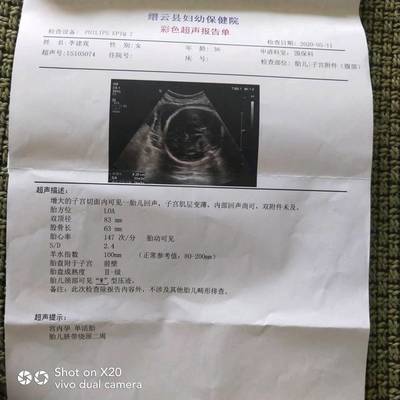 孕妇怀孕32周是几个月