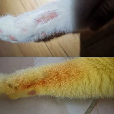人长猫癣怎么治疗