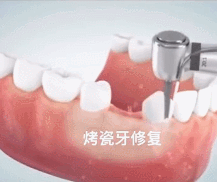 牙齿 磨小