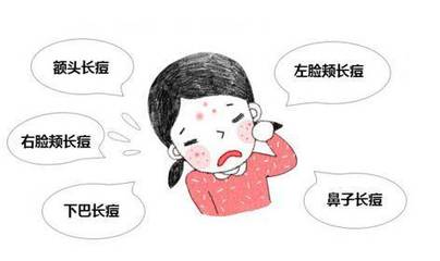 右脸颊为什么会长痘痘