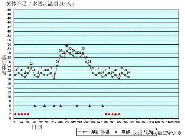 基础体温正常情况下是多少