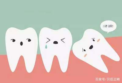 蛀牙引起的牙疼怎么办