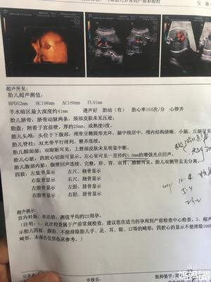 孕妇需要做心脏彩超吗