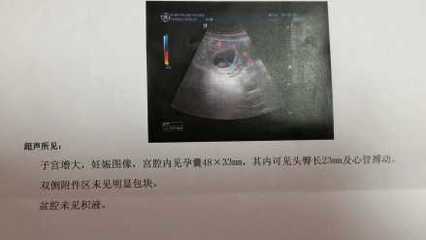 3个月可以药流吗