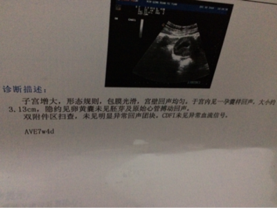 孕囊里没有胚芽是怎么回事