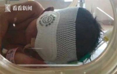 宝宝发烧抽搐怎么急救