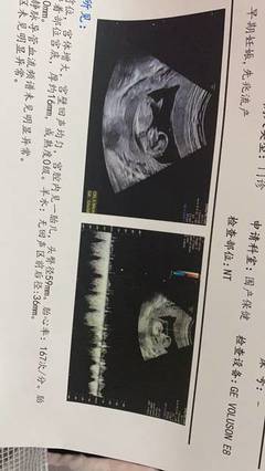 桥本氏甲状腺炎可以怀孕吗