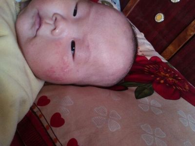 一岁宝宝不消化拉肚子怎么办
