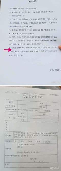 伤残鉴定报告拿到后多久拿到赔偿