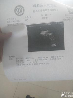 孕三十三周是几个月