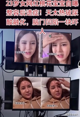 玻尿酸填充鼻子后遗症