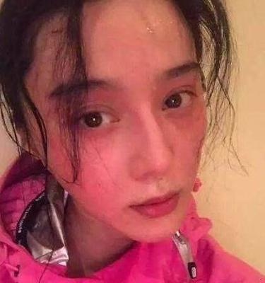 脸颊泛红是怎么回事