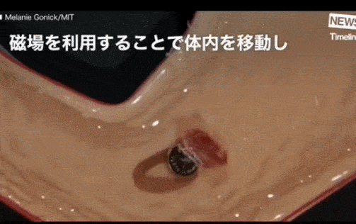 机器人胶囊 异物