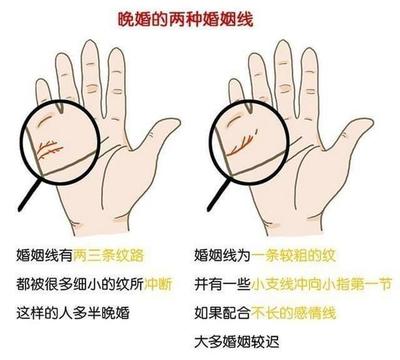 婚姻线有痣