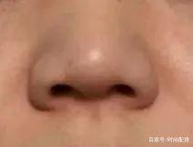 鼻子变大是怎么回事