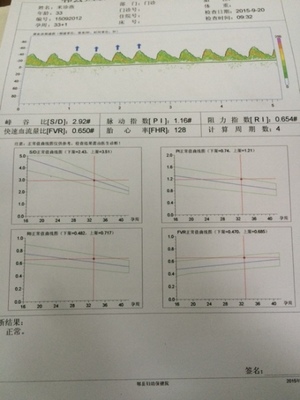 怎么看眉毛算命图解