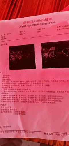 几个月没怀孕正常吗