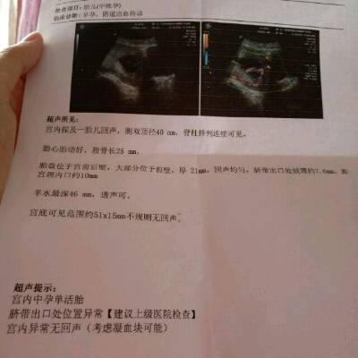 怀孕后要做什么检查