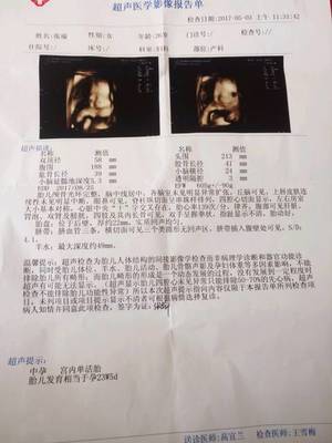 怀孕六个月做四维晚吗