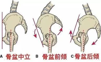 下半身酸痛是怎么回事