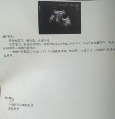 全麻之后多久可以怀孕