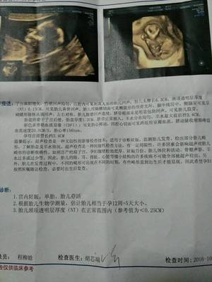 怀孕12周胎儿会动吗