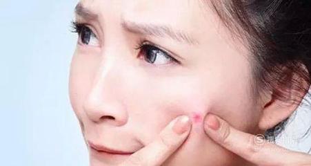 脸上长好多痘痘要怎么保养
