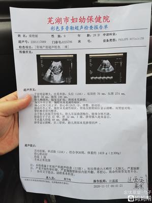 怀孕30周胎动频繁正常吗