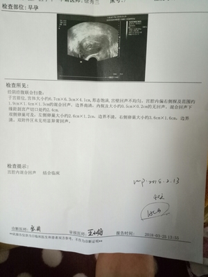 怀孕检测报告单