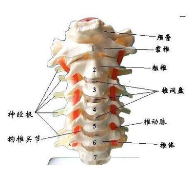 神经根颈椎病怎么治疗最好