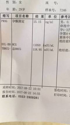 刚好30天能测出怀孕吗