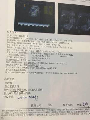 胎儿心包腔少量积液