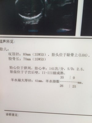 34周胎儿股骨长标准值