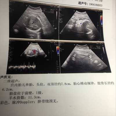 31周胎儿一般多重