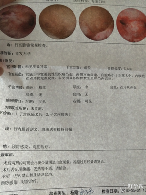 宫腔镜的检查多少费用