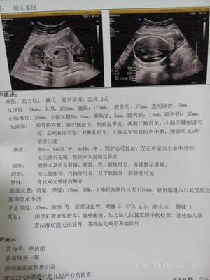 胎儿22周图片