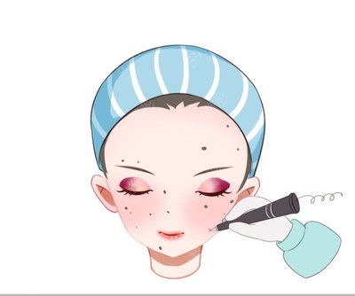 怀孕可以祛痣吗