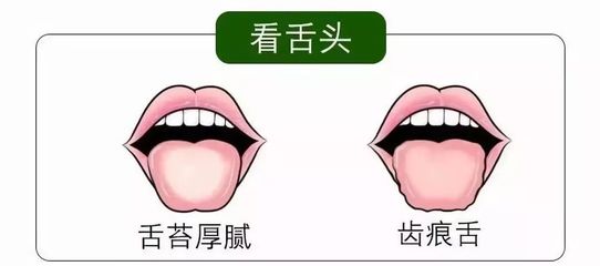 舌苔没了是怎么回事