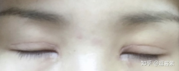 双眼皮闭眼照