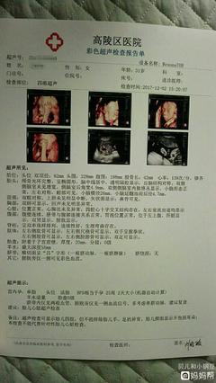 24周胎宝宝发育标准是多少