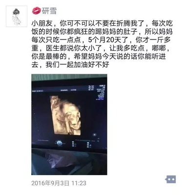 朋友圈暗示怀孕可爱图